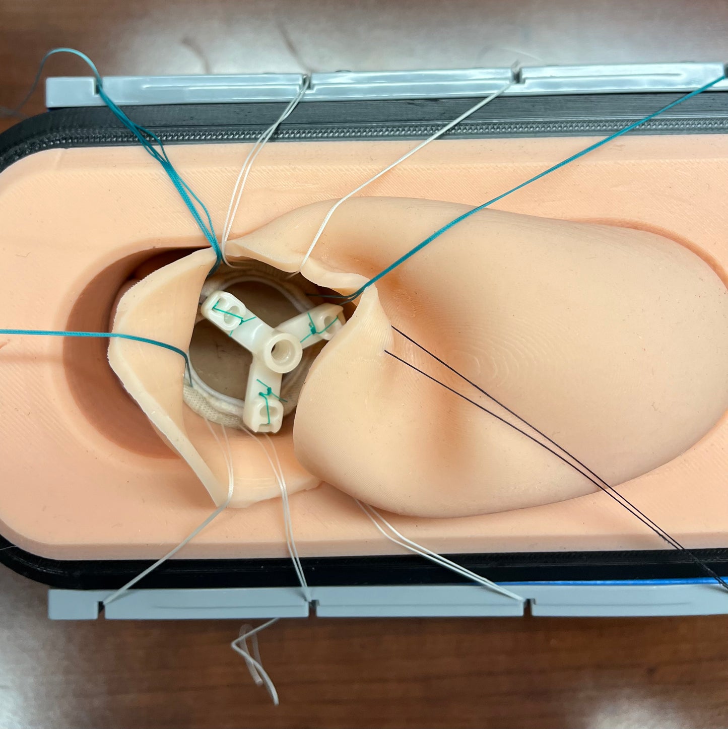 Ascending Aorta with Aortic Valve Annulus and Base - Call for Volume Pricing SKU SSAVR21010
